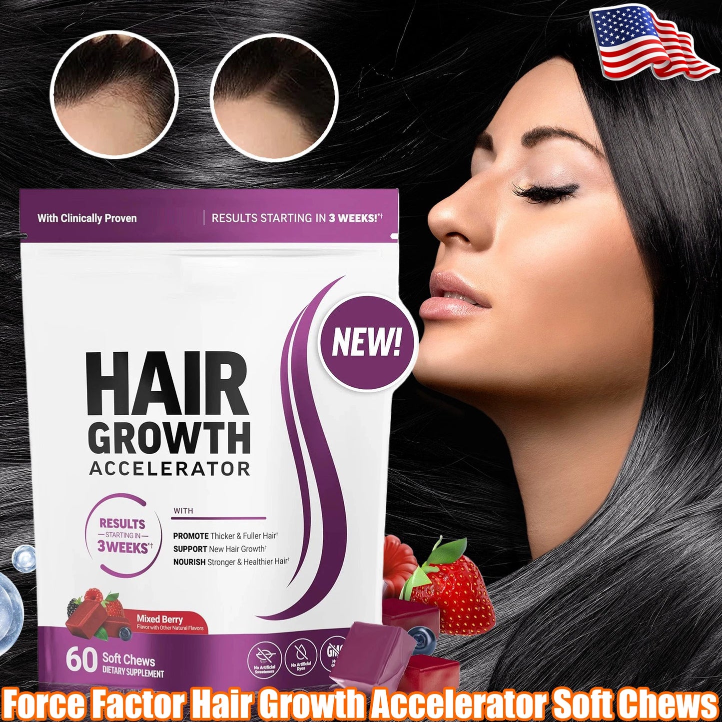 Hair Growth Accelerator Soft Chews