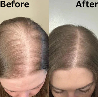Hair Growth Accelerator Soft Chews