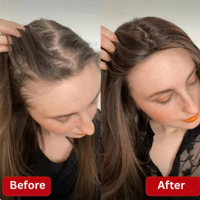 Hair Growth Accelerator Soft Chews
