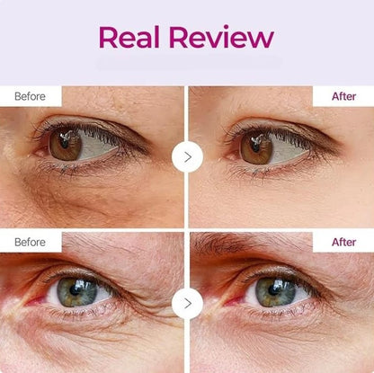 Calcium Multi Balm 💫 Anti-Aging & Firming Korean Skincare Stick🔥